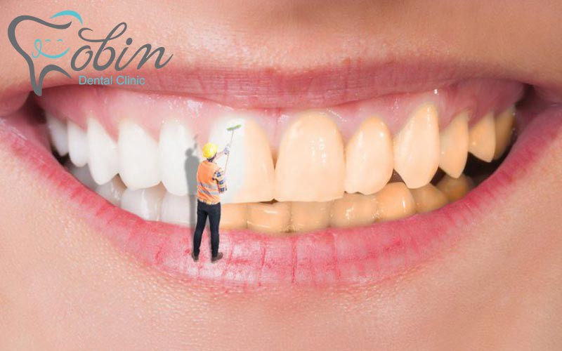 غذاهای اسیدی به شدت برای دندان و بلیچینگ مضر هستند